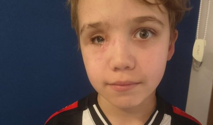 Ajudar um príncipe a tratar e recuperar a saúde do seu olhinho