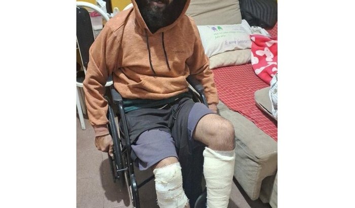 Motoboy/Autônomo: Apoio após acidente até voltar a trabalhar