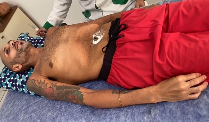 Cirurgia para doença de acalasia