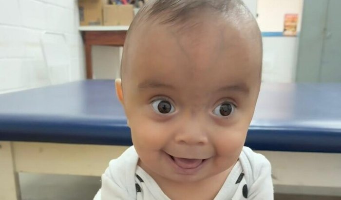 AJUDE O GAEL A CONTINUAR LUTANDO PELA VIDA ❤️