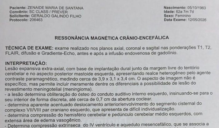 Cirurgia de Tumor Cerebral (Meningioma 4cm)