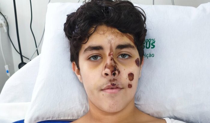 Ajuda para conseguir prótese de dentes