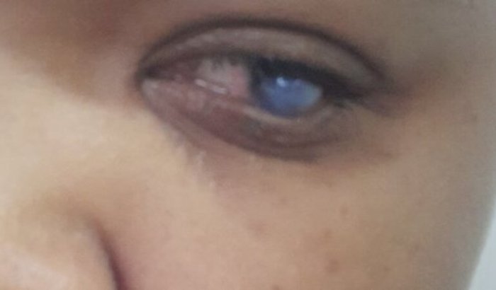 Quero ajunda para fazer minha cirurgia olhos