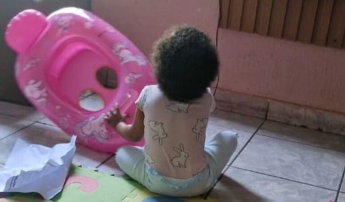 Ajude a Zoe a fazer uma Neurocirurgia! Salve uma Vida!