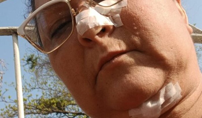 Uma chance de voltar a viver com dignidade - luta contra a Neurofribomatose