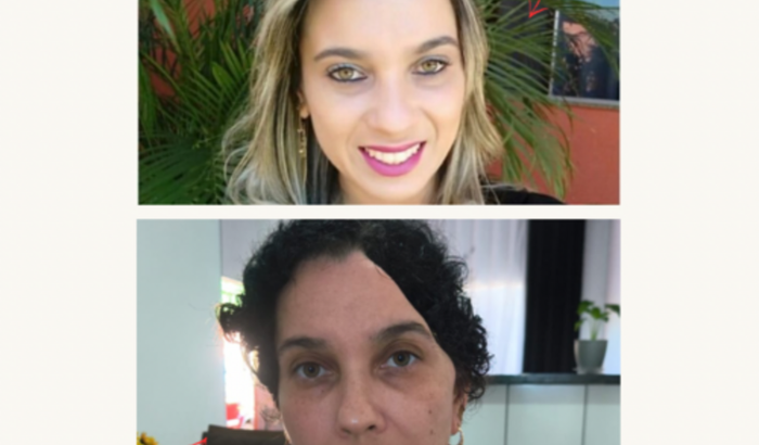 Ajude a Cássia com a prótese para cabeça