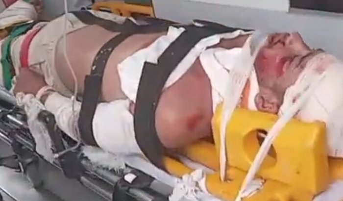Ajuda na minha recuperação
