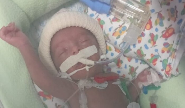Ajuda p minha filha, pois nasceu prematura extrema e necessita de acompanhamentos, pois tem várias crises.