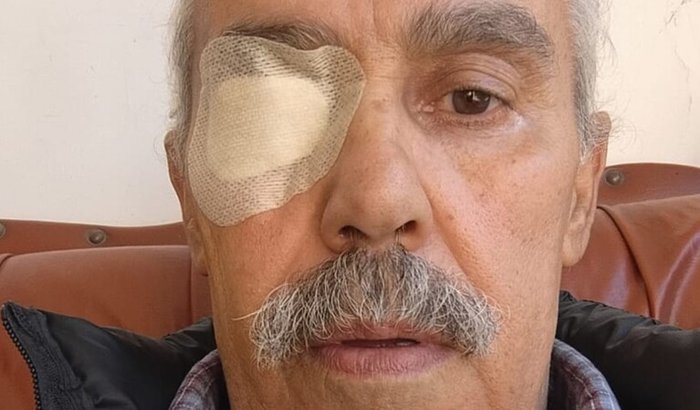 Ajude Fernando da Rainha a recuperar sua visão