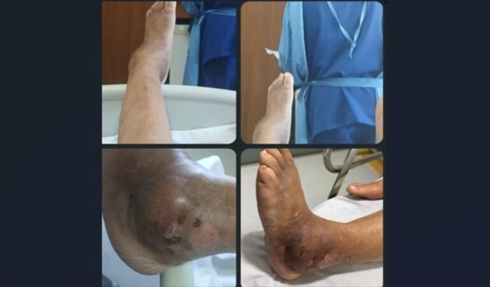 AJUDE URSULA NA SUA CIRURGIA