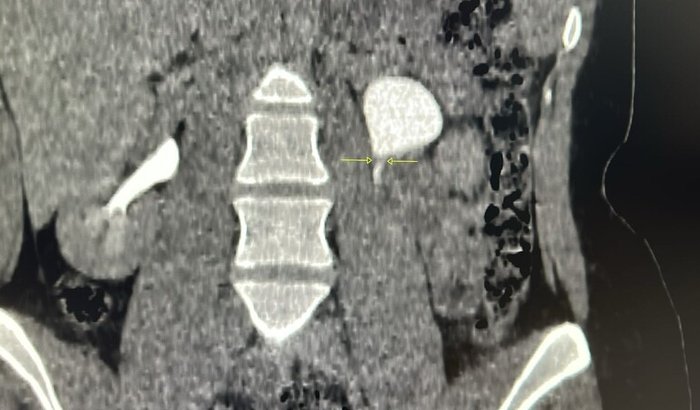 Ajuda para cobrir os custos da cirurgia da Ju