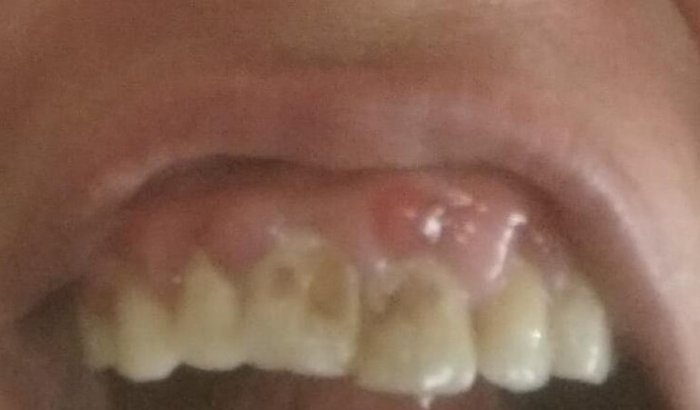 Ajuda para cirurgia ortodôntica