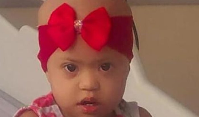 Juntos pela cirurgia da Pequena Jasmin 2 anos