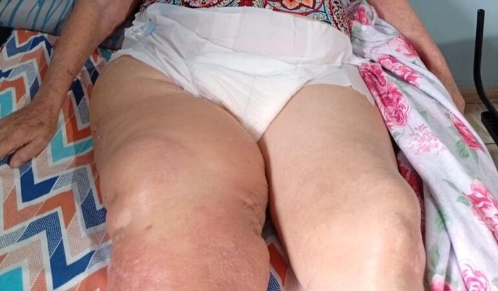 Ajuda para comprar uma cama hospitalar