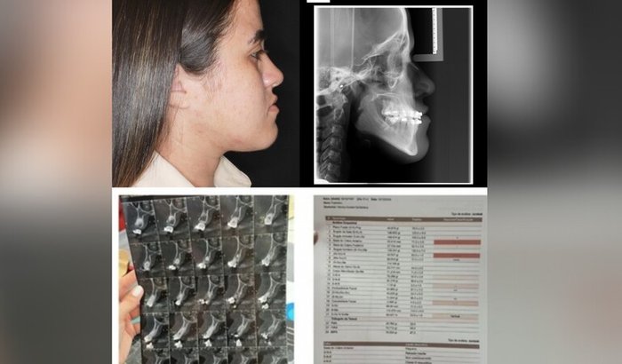 cirurgia bucomaxilofacial