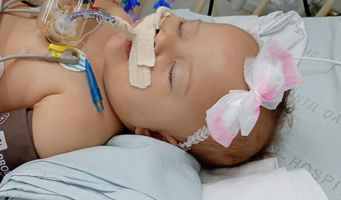 Ajuda pra terminar de comprar as coisinhas pra festa de 1 ano da minha bebê por favor