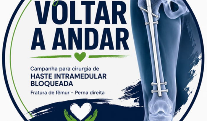 Haste Intramedular- Pedro Henrique