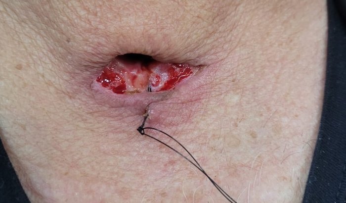 Ajuda com cirurgia e tratamento de câncer
