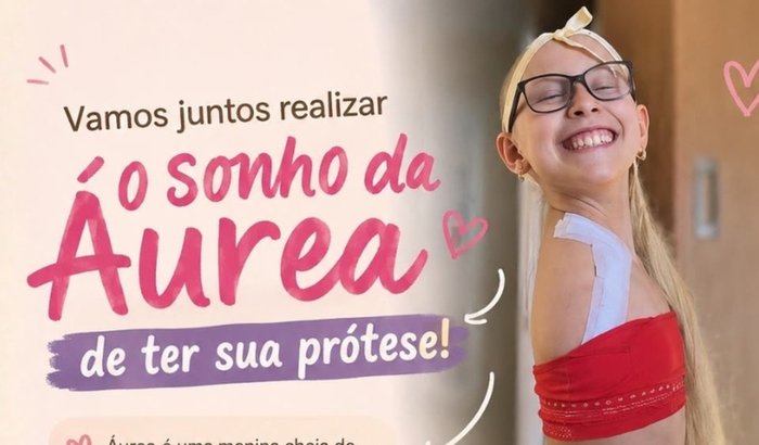 Áurea bravo - Prótese do braço direito