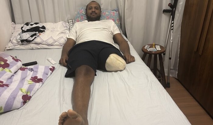 Prótese para o Marcão
