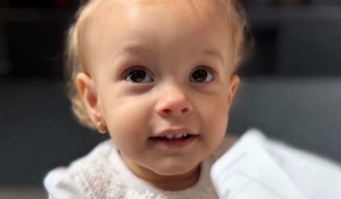Cirurgia Cerebral da Belinha