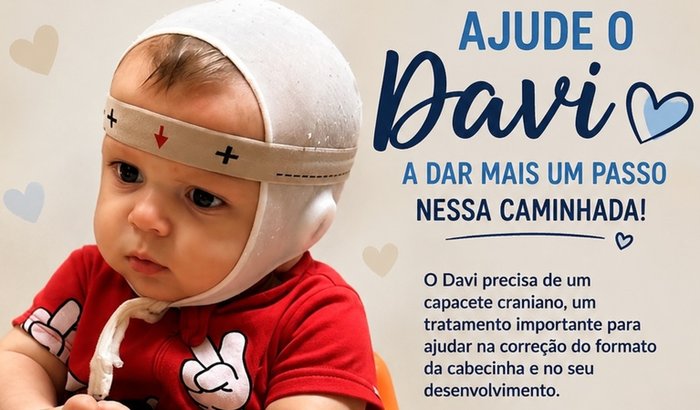 Ajude o Davi Calixto com sua órtese craniana 🙏🏻