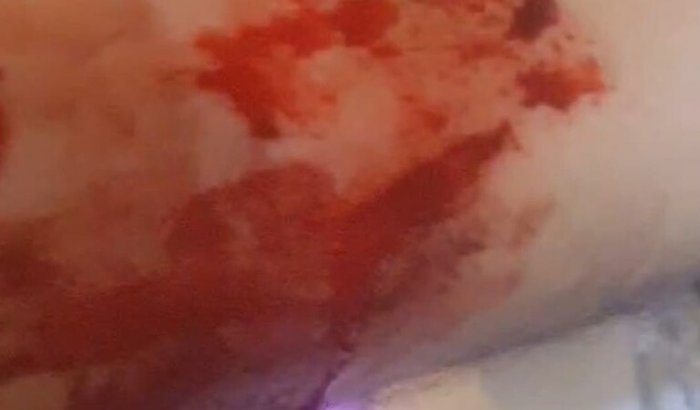 Risco real de suicídio. tenho TAG no graus de ato mutilação