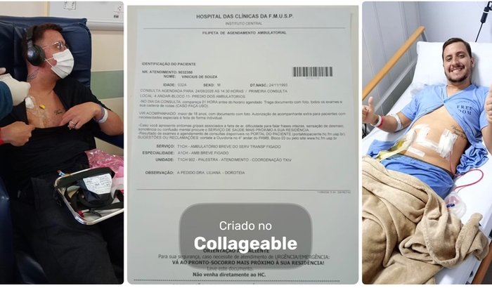 Custos para a cirurgia de transplante