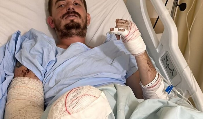 Arrecadar recursos para a compra da minha prótese e para auxiliar no processo de recuperação e reabilitação.
