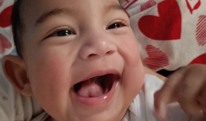 Ajude o Dominik na luta contra síndrome de west