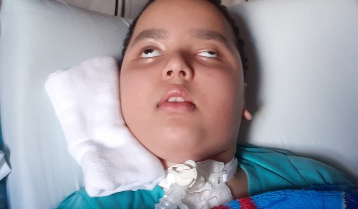 Miguel Arthur ALD ( Adrenoleucodistrofia)