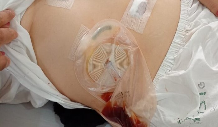 Ajuda para cirurgia da minha filha