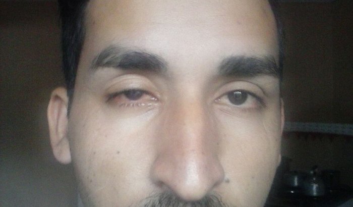 Ajude o Renato 