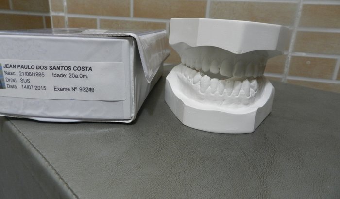 Cirurgia Buco Maxilo