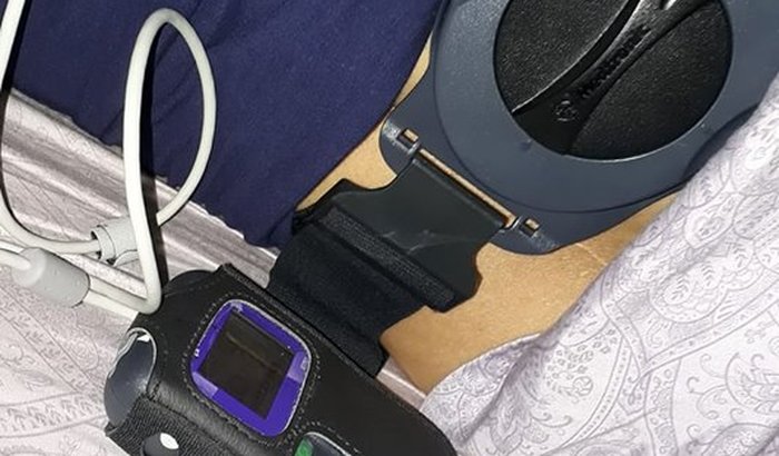 Tratamento para Síndrome Dolorosa Complexa