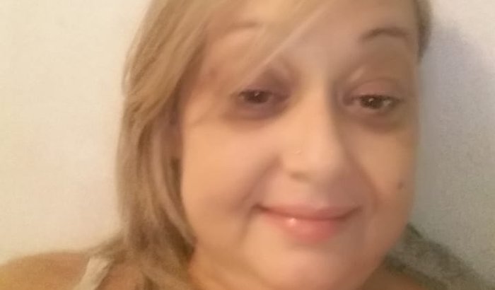 Tratamento de Doença Linfoproliferativa