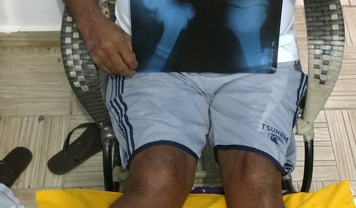 CIRURGIA ORTOPÉDICA NO JOELHO