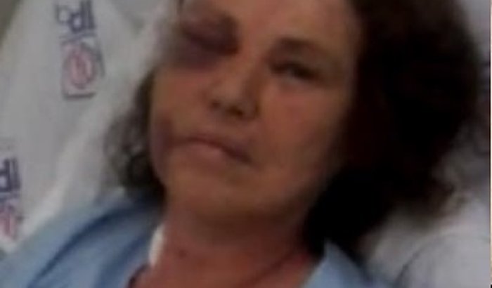 Ajude minha mãe na luta contra um tumor cerebral 