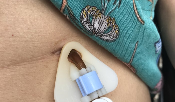 Ajuda pra pagar troca da sonda da Mônica