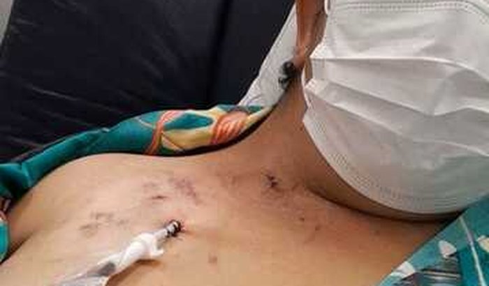 Despesas médicas enquanto o meu transplante renal não vem...
