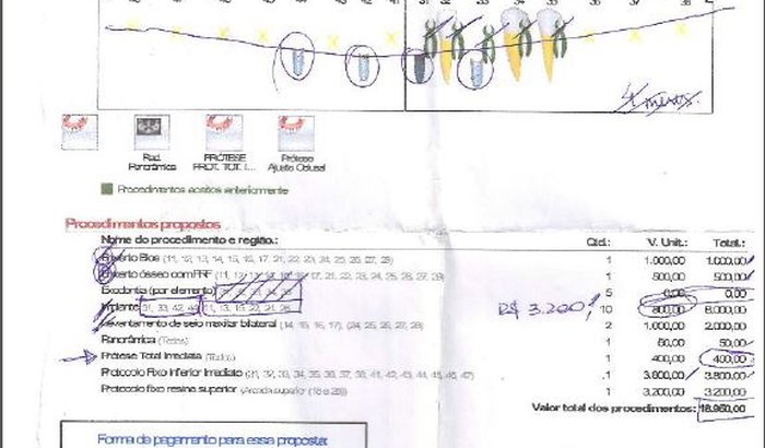 TRATAMENTO CIRURGICO DE ALTO CUSTO