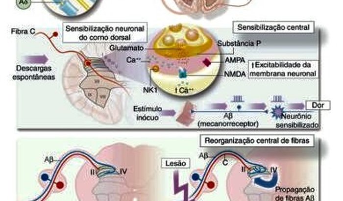 Ajudem o Edson a comprar uma cadeira de Rodas Motorizada