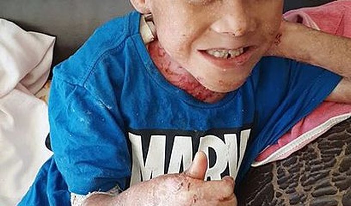 Todos pelo Davi, o menino borboleta