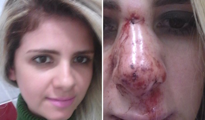 Vamos ajudar a Ana! #chegadeviolência #basta #nãovamosnoscalar