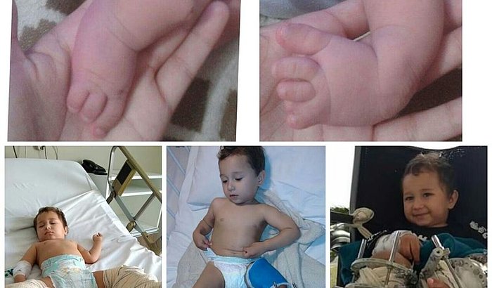 Ajude o Arthur a continuar andando.