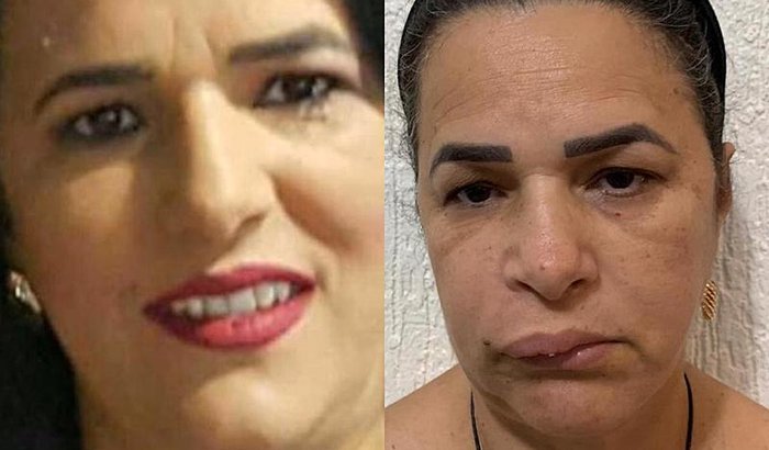 SOS PELA SAÚDE DA ANTÔNIA - (CÂNCER) melanoma metastático