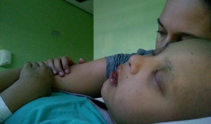 Tratamento Laysa